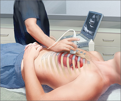 Point of Care Ultra Sound (POCUS) - The Basic